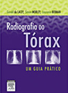 Radiografia do T&oacute;rax: Um Guia Pr&aacute;tico